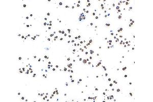 Immunocytochemistry (ICC) image for anti-Metastasis Associated in Colon Cancer 1 (MACC1) (AA 100-150) antibody (ABIN7453975) (Recombinant MACC1 antibody  (AA 100-150))