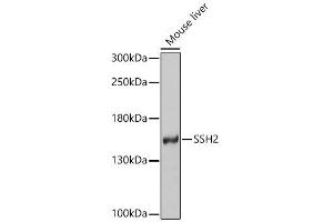 Western blot analysis of extracts of various cell lines, using SSH2 antibody (ABIN4905305) at 1:1000 dilution. (JAM2 antibody)