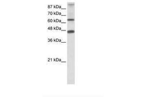 Image no. 1 for anti-Zinc Finger Protein 79 (ZNF79) (AA 107-156) antibody (ABIN202665)