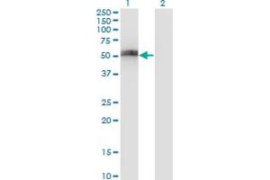 Western Blot analysis of SPP1 expression in transfected 293T cell line by SPP1 monoclonal antibody (M17), clone 3G6. (Osteopontin antibody  (AA 21-129))