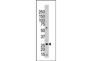 The YWHAZ polyclonal antibody  is used in Western blot to detect YWHAZ in Jurkat cell lysate.