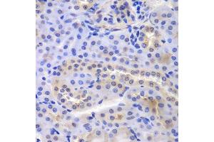 Immunohistochemistry of paraffin-embedded mouse kidney using PSMA6 antibody. (PSMA6 antibody  (AA 1-246))