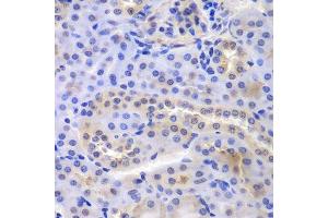 Immunohistochemistry of paraffin-embedded mouse kidney using PSMA6 antibody.