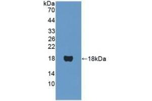 Detection of Recombinant PPARa, Human using Polyclonal Antibody to Peroxisome Proliferator Activated Receptor Alpha (PPARa) (PPARA antibody  (AA 61-170))
