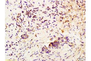 Immunohistochemistry (Paraffin-embedded Sections) (IHC (p)) image for anti-Colony Stimulating Factor 3 (Granulocyte) (CSF3) (AA 155-198) antibody (ABIN736521) (G-CSF antibody  (AA 155-198))