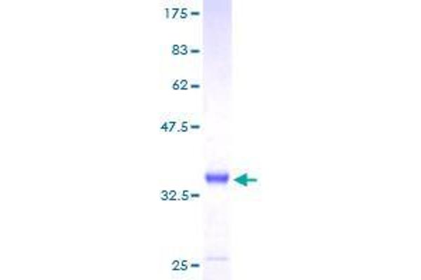 ABRACL/C6orf115 Protein (AA 1-81) (GST tag)