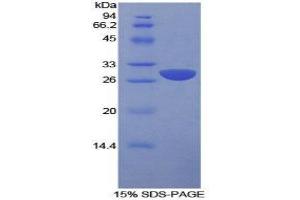 SDS-PAGE (SDS) image for Signaling Lymphocytic Activation Molecule Family Member 1 (SLAMF1) (AA 19-236) protein (His tag) (ABIN2126786) (SLAMF1 Protein (AA 19-236) (His tag))