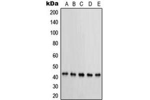 Western blot analysis of PRKAR1B expression in MCF7 (A), KNRK (B), NIH3T3 (C), HeLa (D), BT20 (E) whole cell lysates.