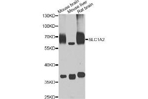 Western blot analysis of extracts of various cell lines, using SLC1A2 antibody (ABIN5995519) at 1/1000 dilution. (SLC1A2 antibody)