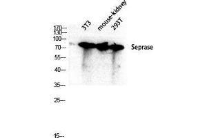 Western Blot (WB) analysis of 3T3 Mouse Kidney 293T lysis using Seprase antibody.