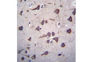 Immunohistochemistry analysis in formalin fixed and paraffin embedded human brain tissue reacted with Fukutin Antibody (Center) followed by peroxidase conjugation of the secondary antibody and DAB staining. (Fukutin antibody  (Middle Region))
