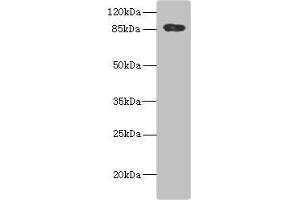 ADAM28 anticorps  (AA 199-440)
