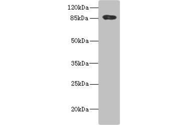 ADAM28 anticorps  (AA 199-440)