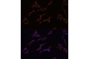 Immunofluorescence analysis of C6 cells using RPL7A Polyclonal Antibody (ABIN6128657, ABIN6147150, ABIN6147152 and ABIN6217809) at dilution of 1:100 (40x lens). (RPL7A antibody  (AA 1-266))
