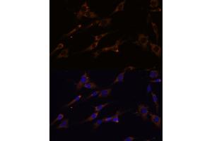 Immunofluorescence analysis of C6 cells using RPL7A Polyclonal Antibody (ABIN6128657, ABIN6147150, ABIN6147152 and ABIN6217809) at dilution of 1:100 (40x lens). (RPL7A antibody  (AA 1-266))