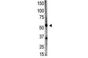 Image no. 1 for anti-Growth Differentiation Factor 5 (GDF5) (N-Term) antibody (ABIN357461) (GDF5 antibody  (N-Term))