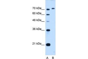 Western Blotting (WB) image for anti-GPI Anchor Attachment Protein 1 (GPAA1) antibody (ABIN2462976)