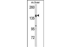 Western blot analysis of ADAMTS18 Antibody in mouse liver tissue lysates (35ug/lane) (ADAMTS18 antibody  (C-Term))