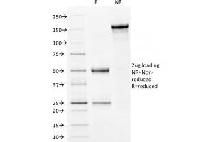 SDS-PAGE Analysis Purified Filaggrin Mouse Monoclonal Antibody (FLG/1561). (Filaggrin antibody  (AA 198-288))