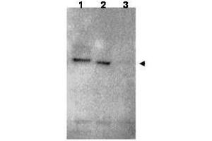 Western blot using  affinity purified anti-RNF25 antibody shows detection of RNF25 (arrow head) in HEK293 cells over-expressing human RNF25 (lane 1) or mouse RNF25 (lane 2). (RNF25 antibody  (C-Term))