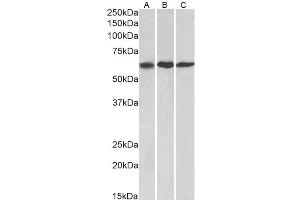 Western Blotting (WB) image for anti-Matrix Metallopeptidase 14 (Membrane-inserted) (MMP14) antibody (ABIN5928778) (MMP14 antibody)