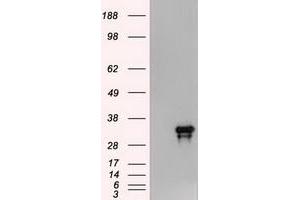 Image no. 2 for anti-Noggin (NOG) (AA 28-232) antibody (ABIN1491315) (NOG antibody  (AA 28-232))
