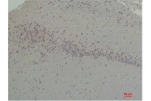 Immunohistochemistry (IHC) analysis of paraffin-embedded Rat Brain Tissue using CABP2 Rabbit Polyclonal Antibody diluted at 1:200.