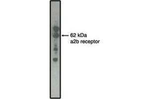 Image no. 1 for anti-Adrenergic, alpha-2B-, Receptor (ADRA2B) antibody (ABIN201731) (ADRA2B antibody)