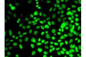Immunofluorescence analysis of MCF7 cells using RP antibody (ABIN6128655, ABIN6147086, ABIN6147088 and ABIN6222439). (RPA3 antibody  (AA 6-121))