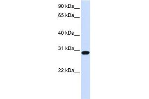 FOXR1 antibody used at 0. (FOXR1 antibody  (N-Term))