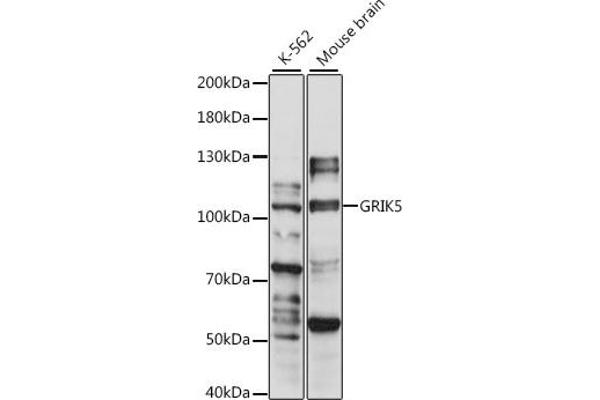 GRIK5 Antikörper  (AA 350-420)