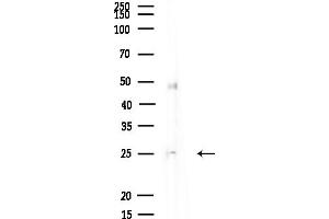 anti-DIRAS Family, GTP-Binding RAS-Like 3 (DIRAS3) (C-Term) antibody