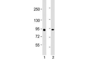 Western blot testing of human 1) Raji and 2) HeLa cell lysate with MYBL2 antibody at 1:2000.
