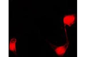 Immunofluorescent analysis of PPHLN1 staining in COLO205 cells. (PPHLN1 antibody  (Center))