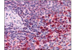 Immunohistochemistry Image: Human Spleen: Formalin-Fixed, Paraffin-Embedded (FFPE) (TXNRD1 antibody  (C-Term))