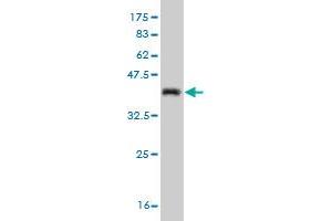 Western Blot detection against Immunogen (35. (CDK4 antibody  (AA 211-303))
