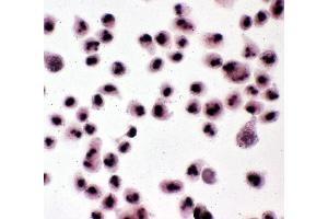 Anti-Nucleophosmin antibody, ICC ICC: HELA Cell (NPM1 antibody  (N-Term))