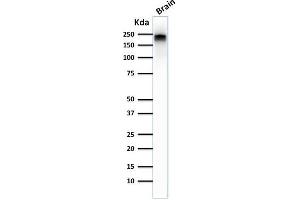 Western Blot Analysis of human Brain tissue lysate using Neurofilament Mouse Monoclonal Antibody (NE14). (NEFH antibody)