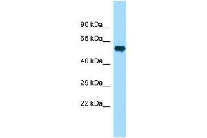 WB Suggested Anti-PIP5K1B Antibody Titration: 1. (PIP5K1B antibody  (C-Term))