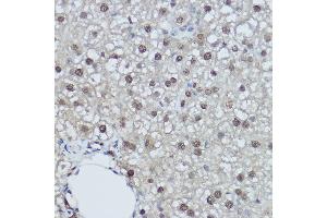 Immunohistochemistry of paraffin-embedded rat liver using DDB1 Rabbit pAb (ABIN1679509, ABIN5664466, ABIN5664468 and ABIN6220382) at dilution of 1:350 (40x lens). (DDB1 antibody  (C-Term))