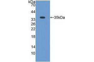 Western blot analysis of recombinant Rabbit PKCb1. (Pkc beta 1 antibody)