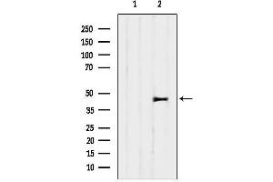 Western blot analysis of lysates from 3, using SERPINH1 Antibody.