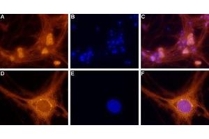 Expression of Adenosine A1 Receptor in rat DRG primary culture - Immunocytochemical staining of paraformaldehyde-fixed and permeabilized rat dorsal root ganglion (DRG) primary culture. (ADORA1 antibody  (3rd Intracellular Loop))