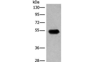 Western blot analysis of Human fetal brain tissue lysate using CDT1 Polyclonal Antibody at dilution of 1:400 (CDT1 antibody)