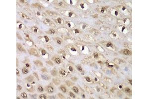 Immunohistochemistry of paraffin-embedded Human esophagus using INTS5 Polyclonal Antibody at dilution of 1:100 (40x lens). (INTS5 antibody)