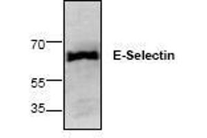 Image no. 1 for anti-Selectin E (SELE) antibody (ABIN127258) (Selectin E/CD62e antibody)