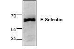 Image no. 1 for anti-Selectin E (SELE) antibody (ABIN127258) (Selectin E/CD62e antibody)