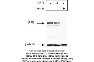 Image no. 1 for anti-Iron-Responsive Element Binding Protein 2 (IREB2) antibody (ABIN363497) (IREB2 antibody)