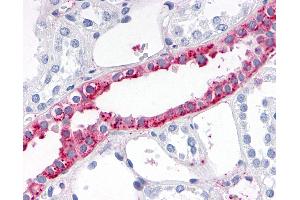 Immunohistochemistry (IHC) image for anti-ADAM Metallopeptidase with Thrombospondin Type 1 Motif, 4 (ADAMTS4) (Disintegrin-like Domain) antibody (ABIN1048291)