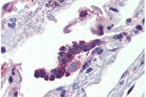 Human Lung, Respiratory Epithelium (formalin-fixed, paraffin-embedded) stained with PLUNC antibody ABIN462235 followed by biotinylated goat anti-rabbit IgG secondary antibody ABIN481713, alkaline phosphatase-streptavidin and chromogen. (BPIFA1 antibody  (AA 101-150))